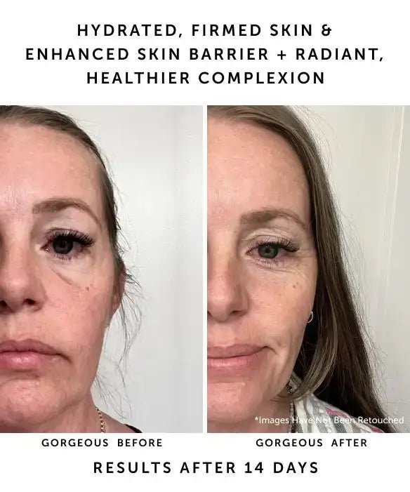 earth harbor before and after results on a middle aged woman after 14 days of using the night cream