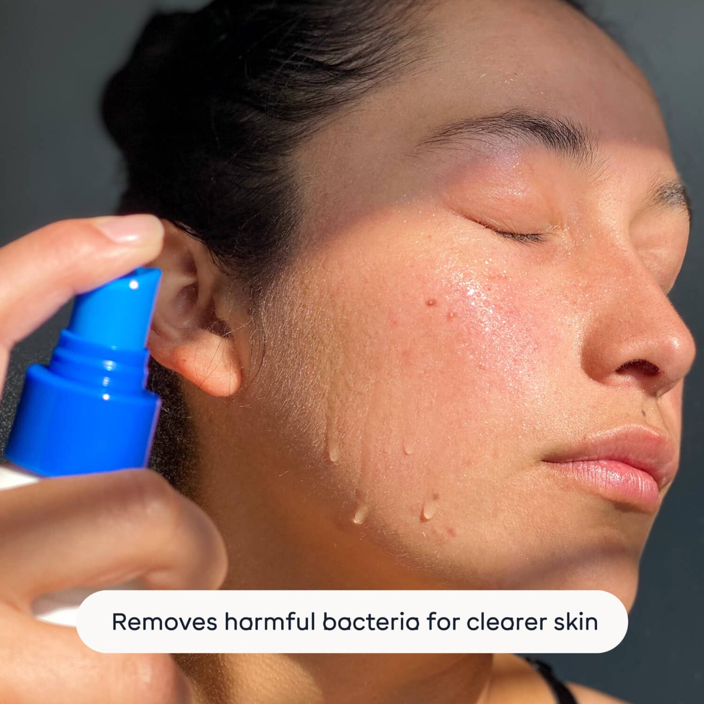 Magic Molecule Hypochlorous Acid Spray Mini applied to woman's face, showing skin hydration and antibacterial benefits for clearer skin.
