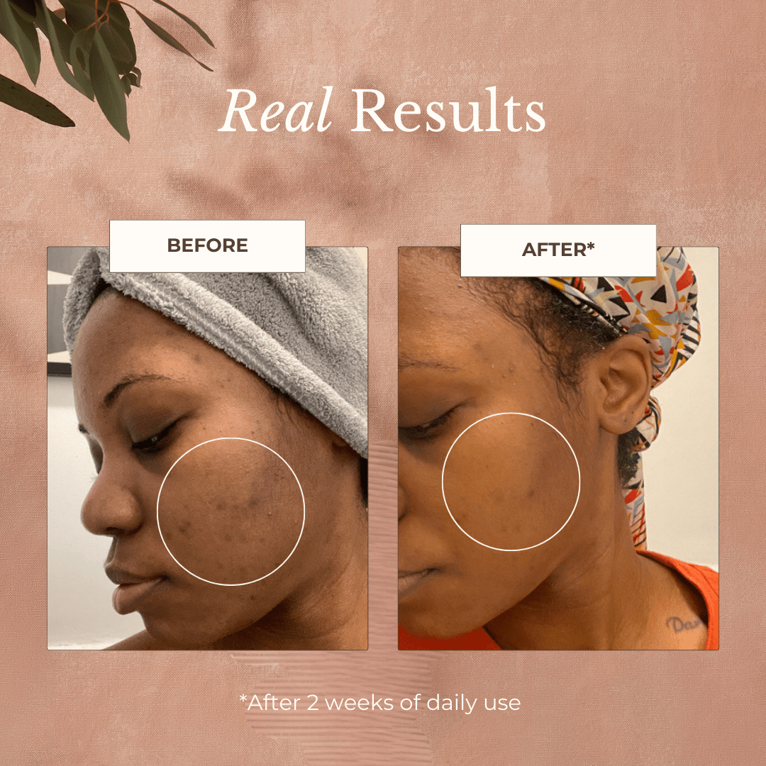 Apoterra - Neroli Clarifying Complexion Mist - Travel Size Clarifying Facial Mist Apoterra at Elle and Willow