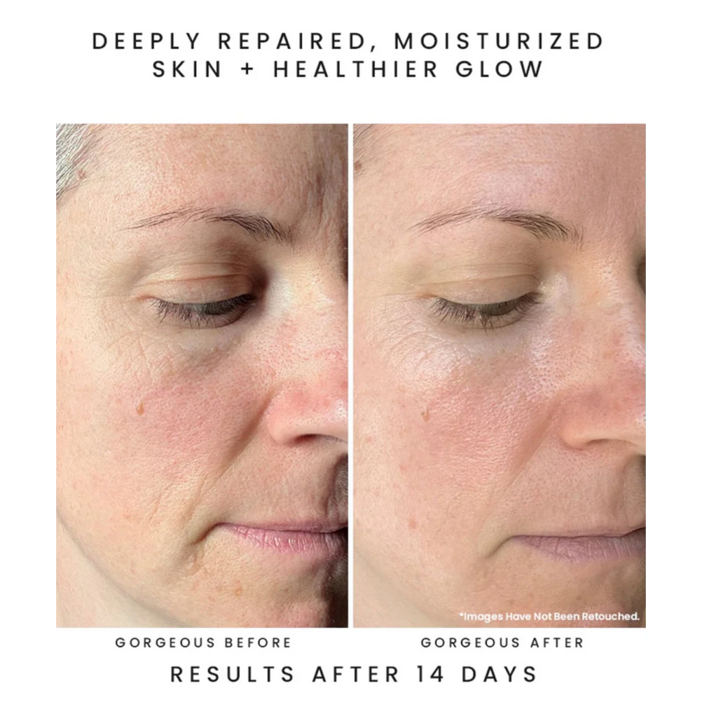Before and after of a woman's face with text indicating deep skin repair and moisturization using earth harbor nymph nectar