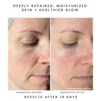 Before and after of a woman's face with text indicating deep skin repair and moisturization using earth harbor nymph nectar