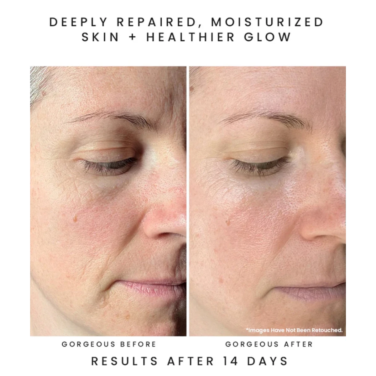 Before and after of a woman's face with text indicating deep skin repair and moisturization using earth harbor nymph nectar