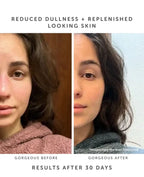 earth harbor marina face serum before and after 30 days of use