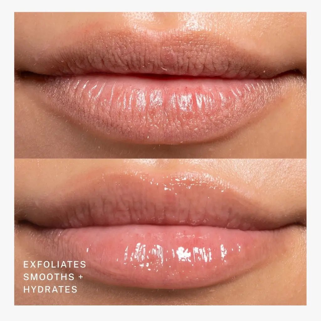 Before and after comparison of lips with exfoliating and moisturizing effects of Fitglow Beauty Night Lip Exfoliating Scrub