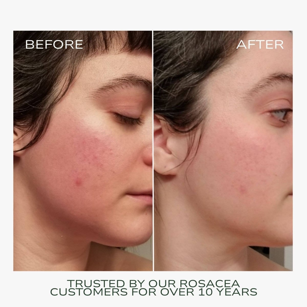 Fitglow Beauty - Redness Rescue Cream - 45ml Hydrating Face Cream at Elle and Willow